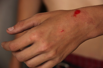 Image showing Bleeding Scraped Wrist