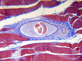 Image showing Microscope-Trichinella spiralis