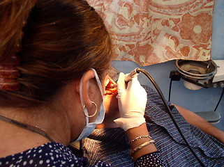 Image showing At the dentist's