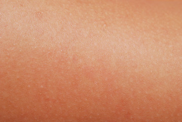 Image showing human skin