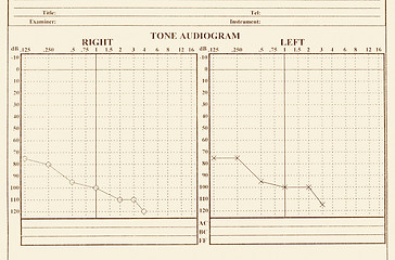 Image showing hearing medical chart showing, audiology