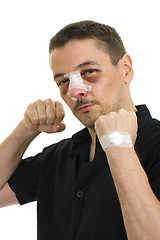 Image showing broken nose post operation