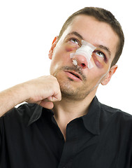 Image showing broken nose post operation