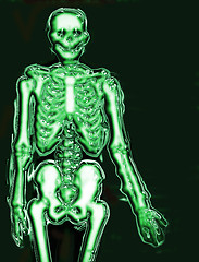 Image showing man and xray