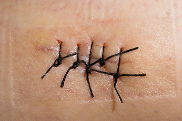 Image showing Scar