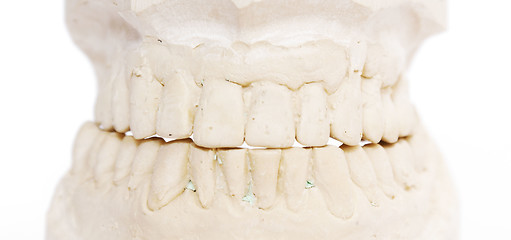 Image showing dental imprint