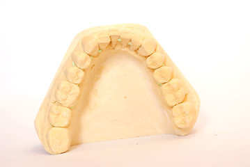 Image showing dental impression 2