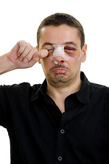 Image showing broken nose post operation