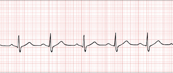Image showing Electronic cardiogram illustration