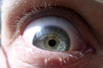 Image showing Eye