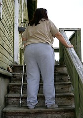 Image showing Poor obese woman with crutch