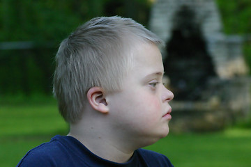 Image showing Down Syndrome Boy Profile