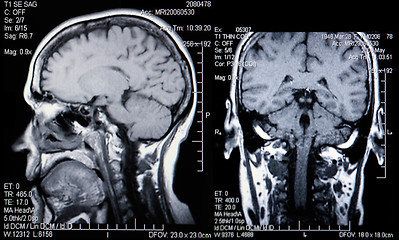 Image showing Real MRI Scans of the Head and Brain