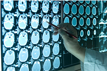 Image showing brain  scan