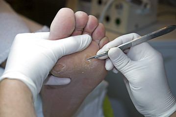 Image showing Pedicure removing hard skin.
