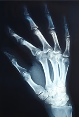 Image showing Xray