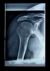 Image showing Xray