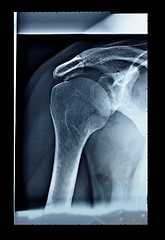 Image showing Xray