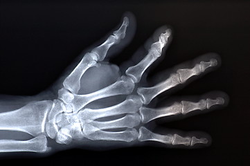 Image showing x-ray of hand