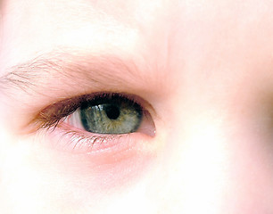 Image showing Child eye