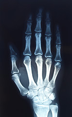 Image showing Xray