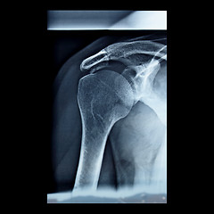 Image showing Xray