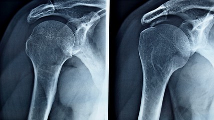 Image showing Xray