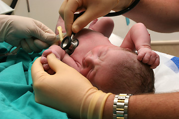 Image showing New born baby