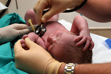 Image showing New born baby