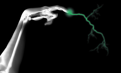Image showing Electric Skeleton Hand 
