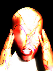 Image showing Migraine Pain