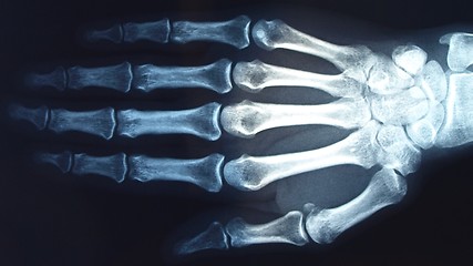 Image showing Xray