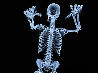 Image showing Xray Skeleton