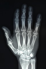 Image showing hand x ray