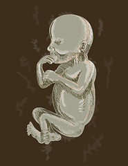 Image showing illustration of a 19 week old fetus