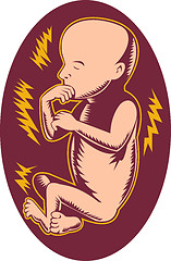 Image showing 19 week old human fetus