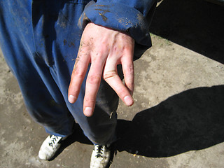 Image showing Broken finger