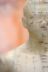 Image showing Acupuncture