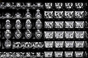 Image showing Magnetic resonance of a brain