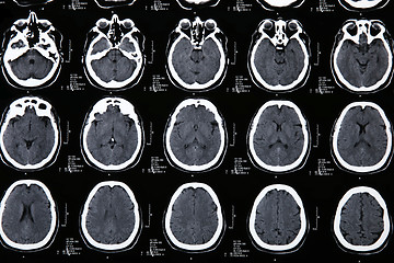 Image showing Magnetic resonance of a brain