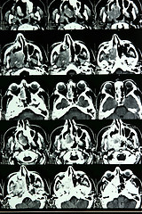 Image showing Magnetic resonance of a brain