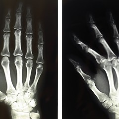 Image showing Xray