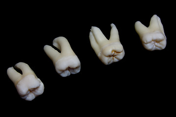 Image showing extracted human teeth