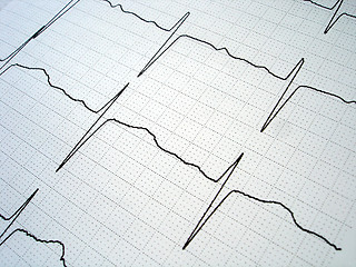 Image showing EKG