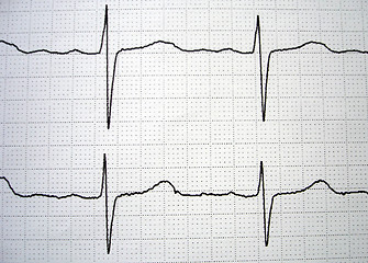 Image showing EKG