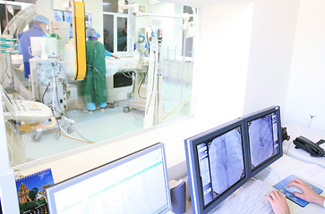 Image showing heart operation 