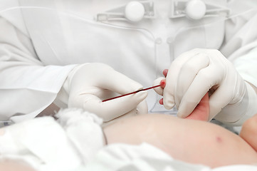 Image showing newly-born child blood sampling
