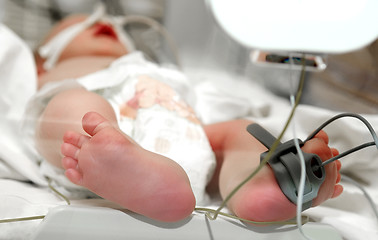 Image showing newborn baby foot in incubator