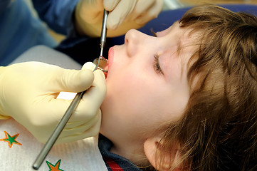 Image showing at a dentist examination