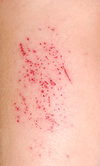 Image showing injury